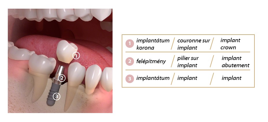 Suba Dental fogászat