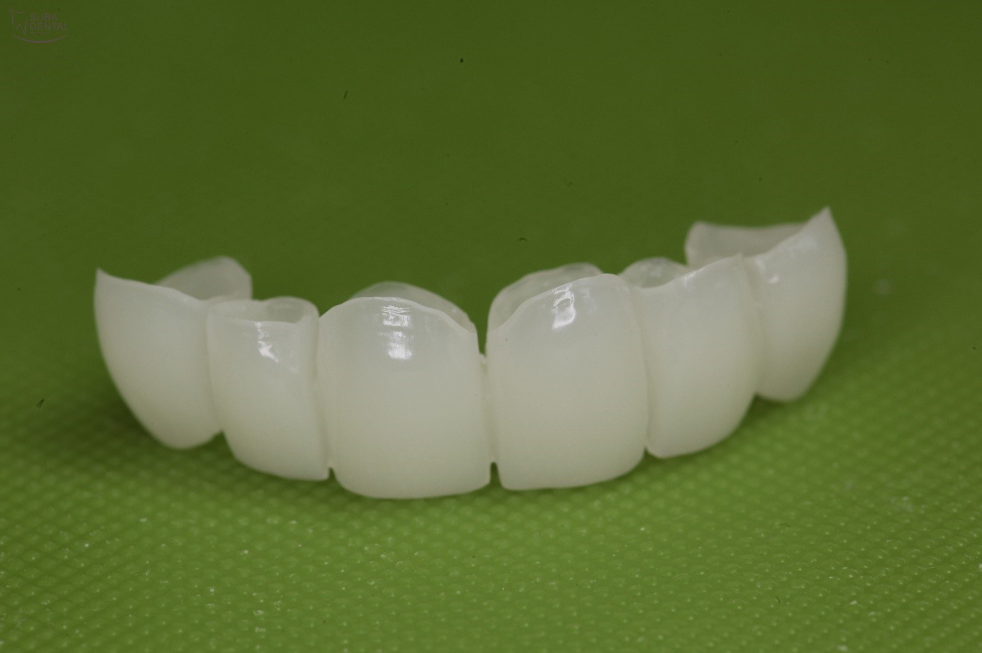 The fabrication of long-term provisional (fixed) tooth restorations from PMMA (polymethyl methacrylate) (99)